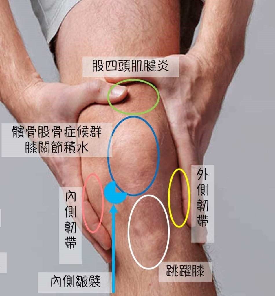 leg pain 3
