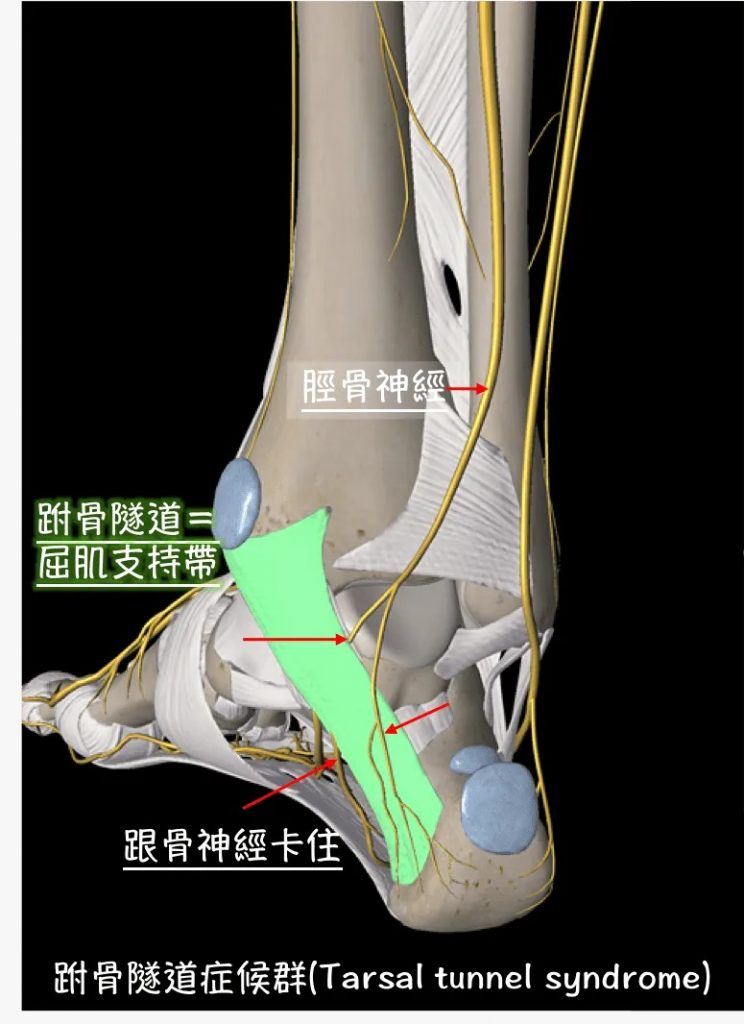 leg pain 4