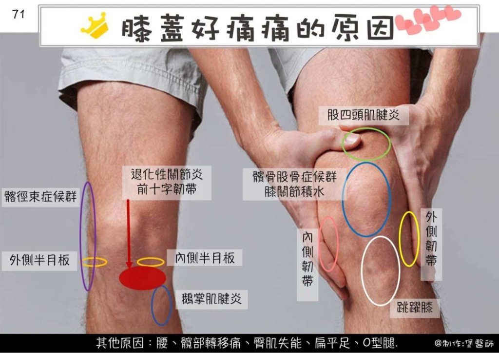leg pain 6