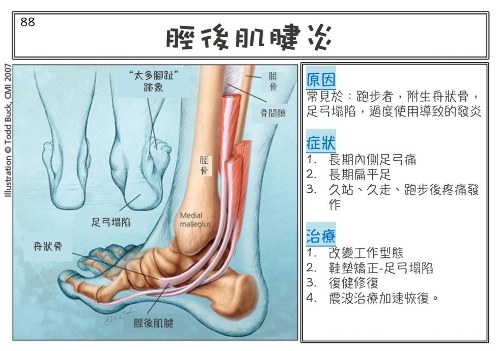 leg pain 8